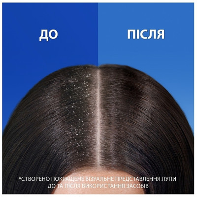 Шампунь Head &amp; Shoulders 2 в 1 Проти лупи Гладеньке та шовковисте 330 мл (8700216304856)