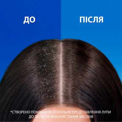 Шампунь Head &amp; Shoulders Pro-Expert 7 Захист від випадіння волосся З кофеїном 250 мл (8700216156936)