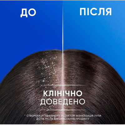 Шампунь Head &amp; Shoulders 2 в 1 Проти лупи Яблучна свіжість 330 мл (8700216304689)