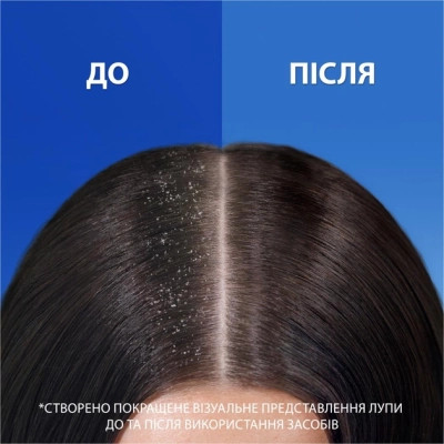 Шампунь Head &amp; Shoulders Проти лупи Цитрусова свіжість 800 мл (8700216156172)