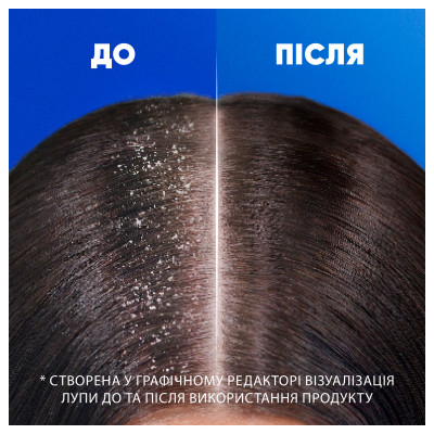 Шампунь Head &amp; Shoulders Основний догляд 250 мл (8006540063330)