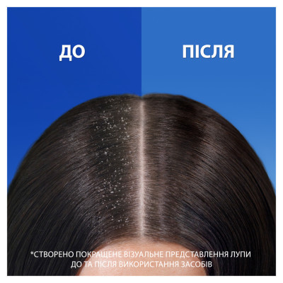 Шампунь Head &amp; Shoulders Свіжість ментолу Проти лупи 400 мл (5011321336094)