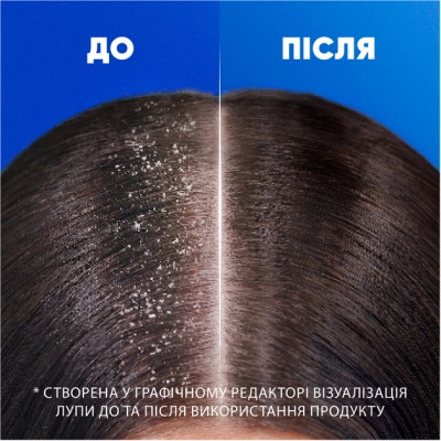 Шампунь Head &amp; Shoulders Цитрусова свіжість 400 мл (5011321336032)
